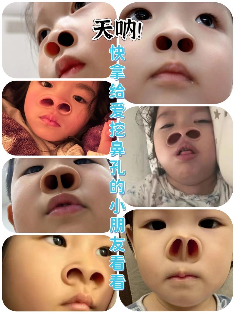 新生儿鼻屎能不能挖？挖了会不会有危险？正确处理方法是什么？-第3张图片-郑州医学网