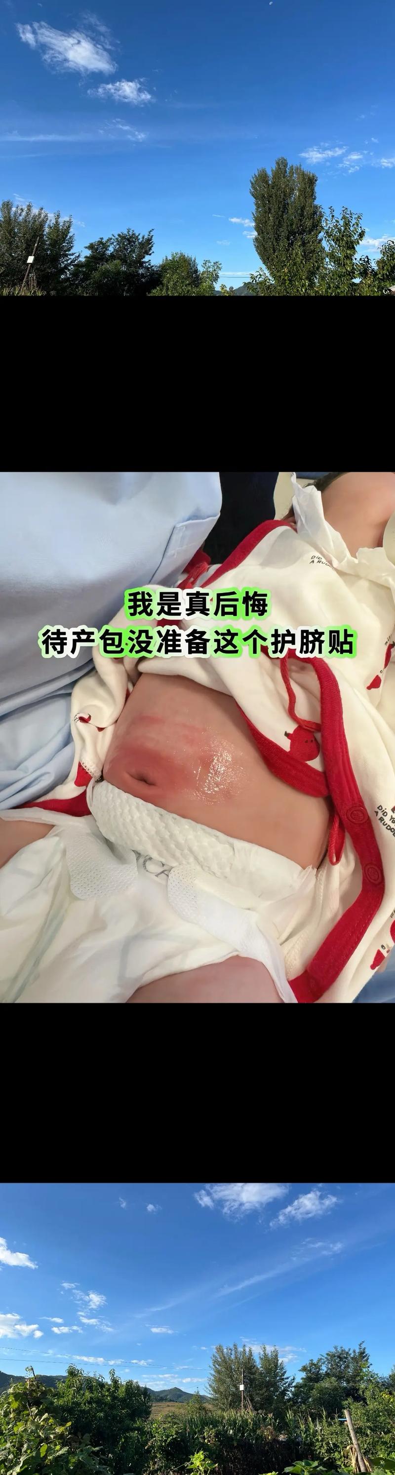 新生儿脐带发炎时宝宝会疼吗？家长该如何观察和处理？-第3张图片-郑州医学网