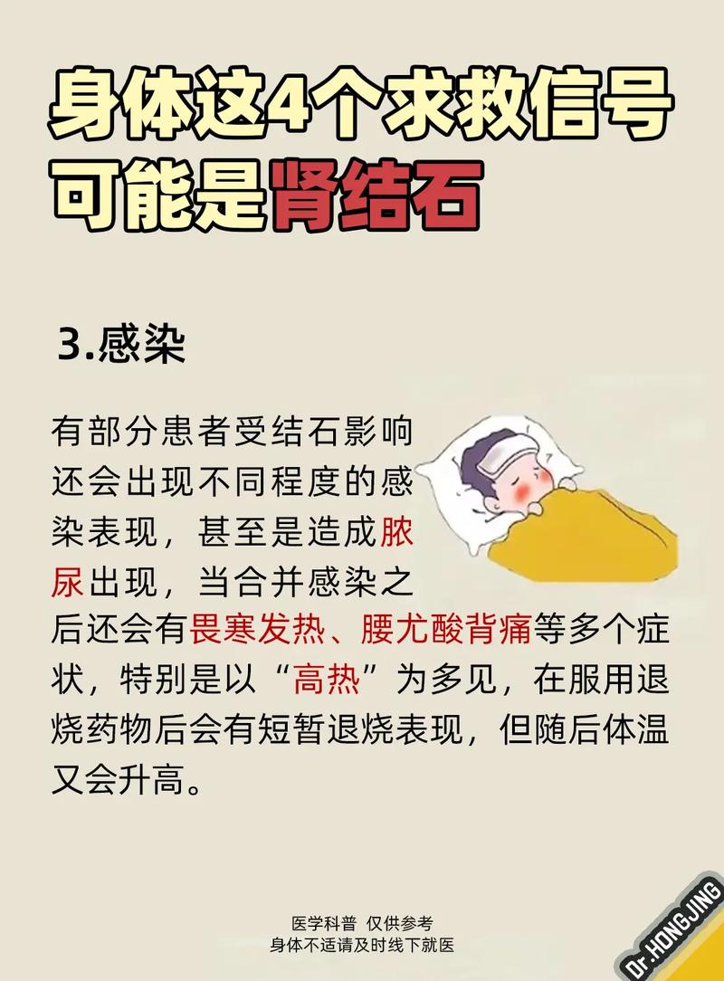 孕期肾结石来袭，身体会发出哪些异常信号？-第3张图片-郑州医学网