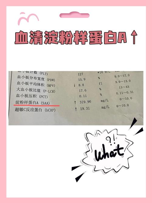 儿童血清淀粉样蛋白升高是严重感染信号还是其他疾病在作祟?-第2张图片-郑州医学网 儿童血清淀粉样蛋白升高是严重感染信号还是其他疾病在作祟?-第2张图片-郑州医学网