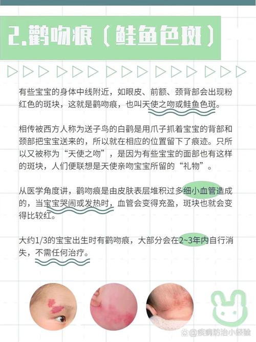 新生儿胎斑究竟是如何形成的，与哪些因素密切相关？-第3张图片-郑州医学网