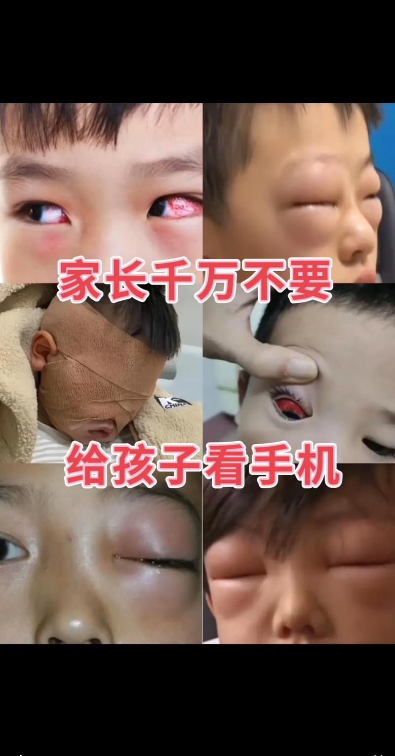 儿童沉迷玩手机，眼睛健康将面临哪些不可逆的潜在危害？-第2张图片-郑州医学网