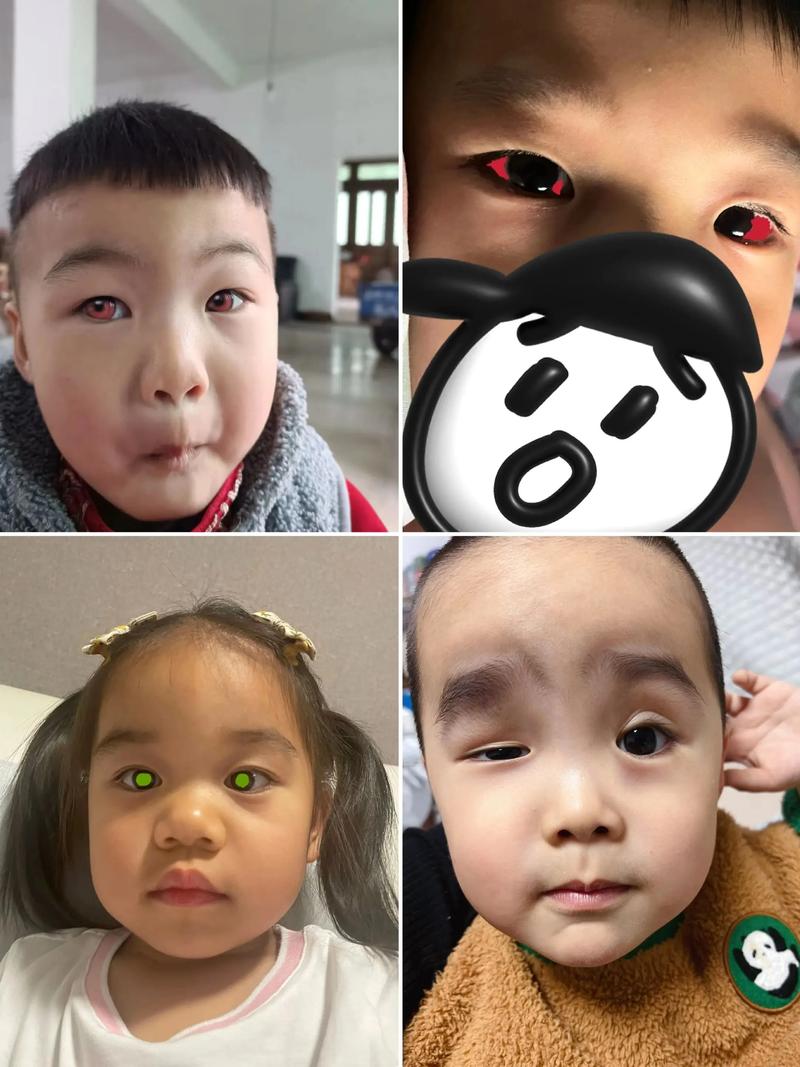 儿童沉迷玩手机，眼睛健康将面临哪些不可逆的潜在危害？-第3张图片-郑州医学网