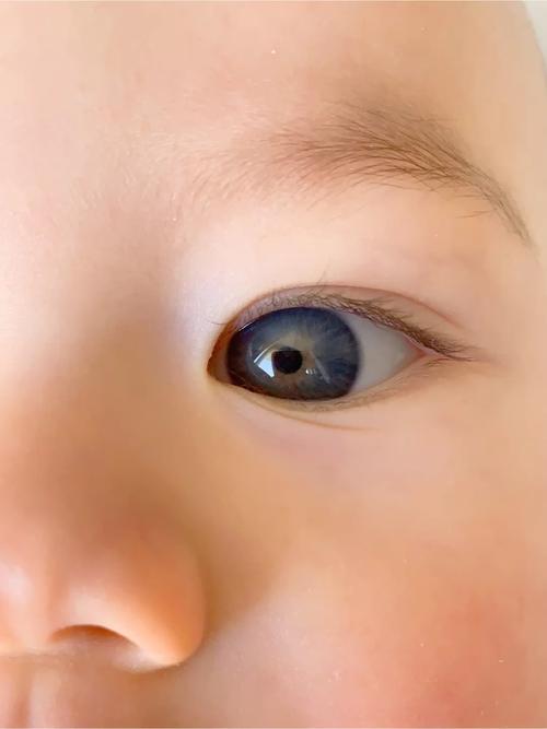 新生儿眼睛呈现蓝色是正常现象吗？会随时间变化吗？-第1张图片-郑州医学网