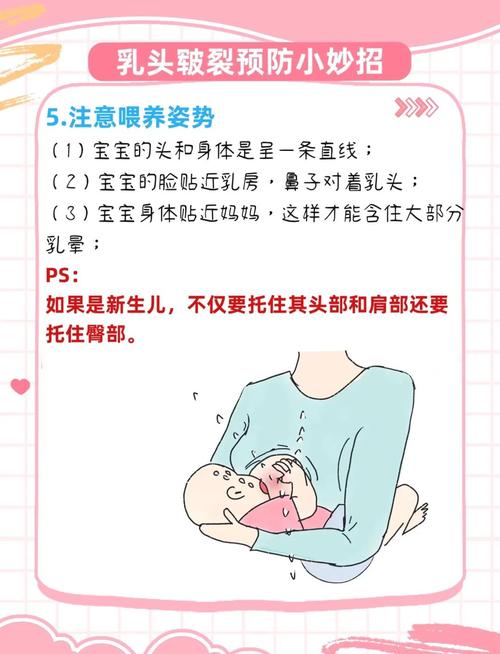 孕期乳头皲裂是何原因导致？如何有效缓解与预防？-第3张图片-郑州医学网