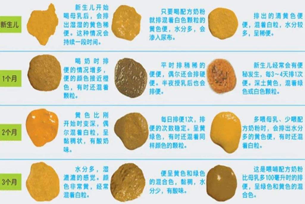 新生儿24小时未排便,是正常生理现象还是需要警惕的健康信号?-第2张图片-郑州医学网 新生儿24小时未排便,是正常生理现象还是需要警惕的健康信号?-第2张图片-郑州医学网