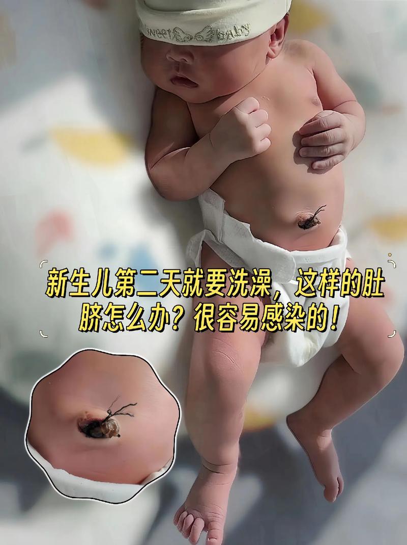 新生儿肚脐发红是正常现象吗？需要警惕哪些潜在问题？-第1张图片-郑州医学网