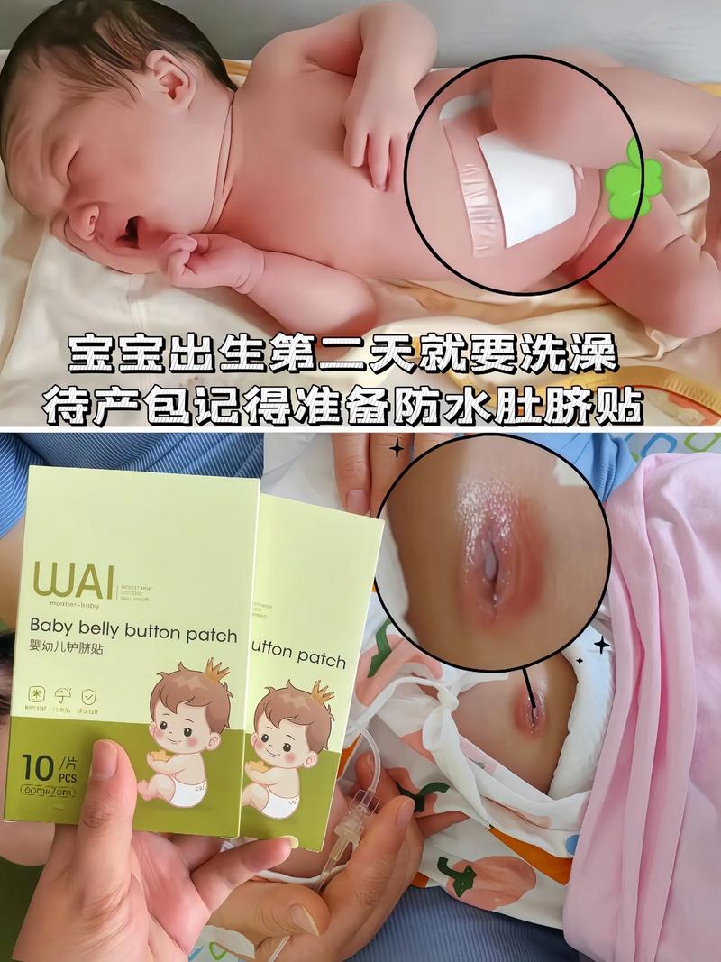新生儿肚脐发红是正常现象吗？需要警惕哪些潜在问题？-第3张图片-郑州医学网