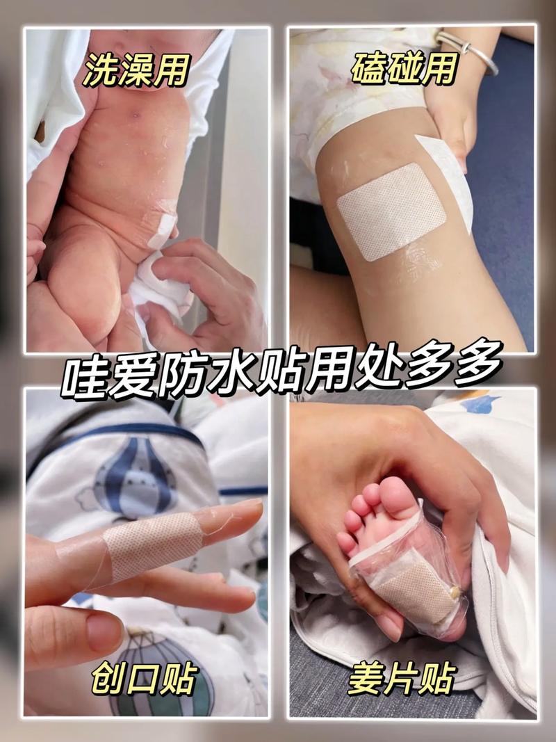 新生儿肚脐擦碘伏要持续多久才算正确？擦多久能避免感染？-第2张图片-郑州医学网