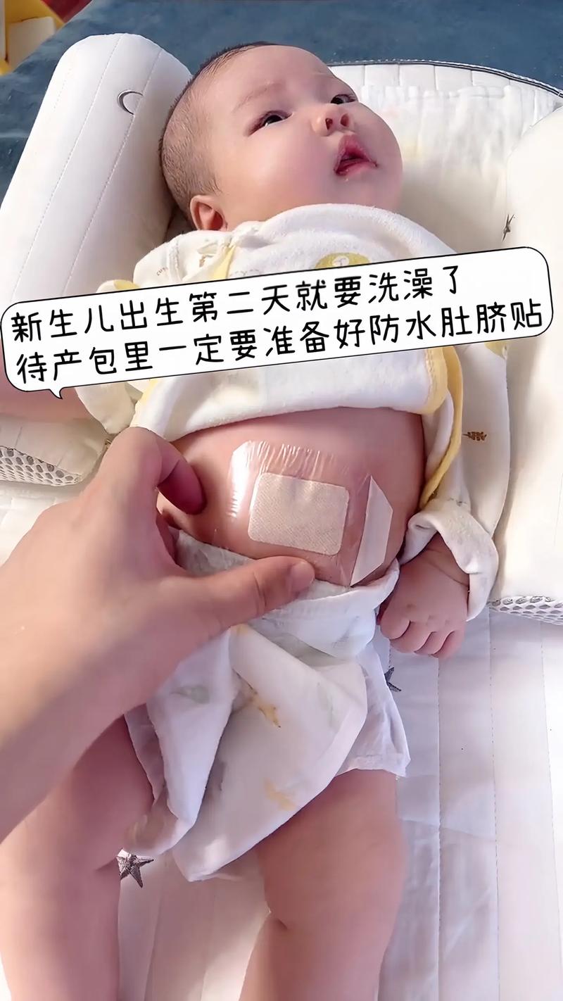 新生儿肚脐擦碘伏要持续多久才算正确？擦多久能避免感染？-第3张图片-郑州医学网