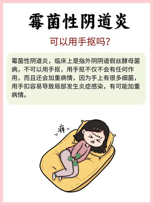 孕期霉菌感染能自行痊愈吗？不治疗会有哪些风险？-第2张图片-郑州医学网