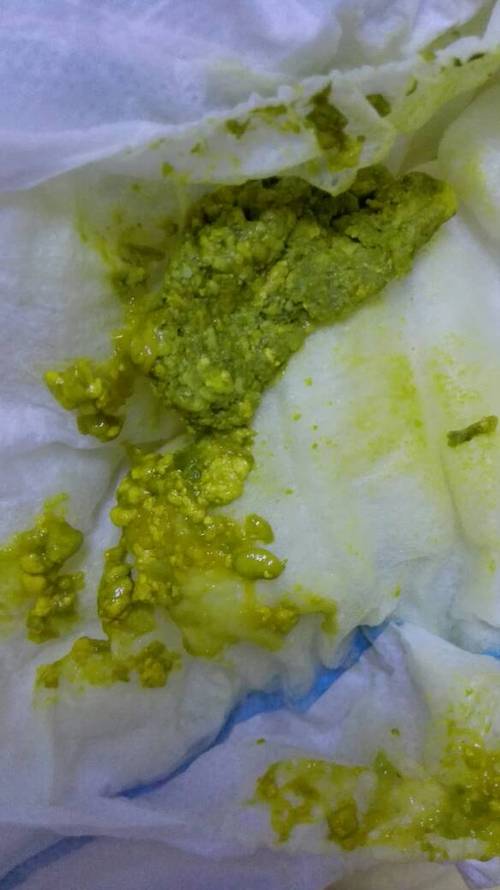 新生儿拉绿色便便是生病了吗？新手爸妈该如何应对？-第2张图片-郑州医学网