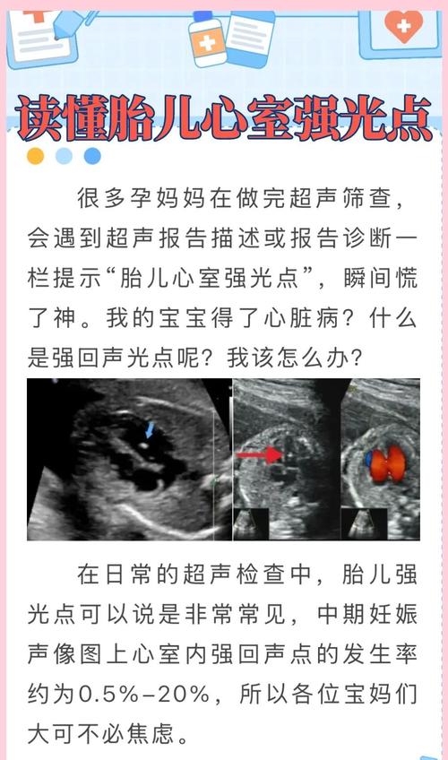 孕期胎儿心脏强光点一定是异常信号吗？需要进一步检查吗？-第1张图片-郑州医学网
