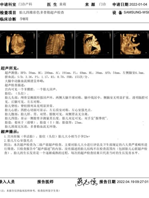 孕期胎儿心脏强光点一定是异常信号吗？需要进一步检查吗？-第2张图片-郑州医学网