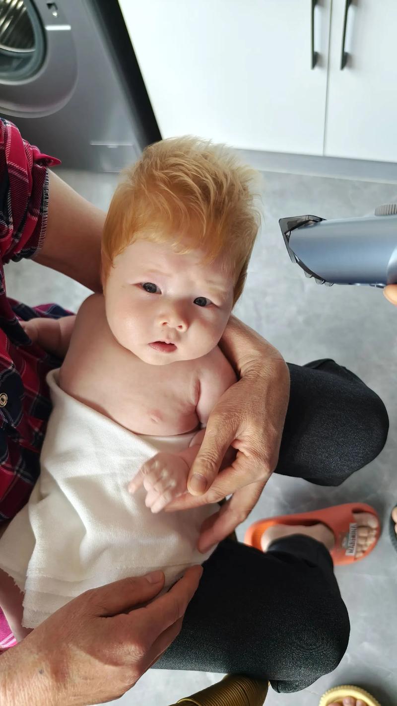 新生儿可以不剪头发吗？剪发对宝宝发育有影响吗？-第2张图片-郑州医学网