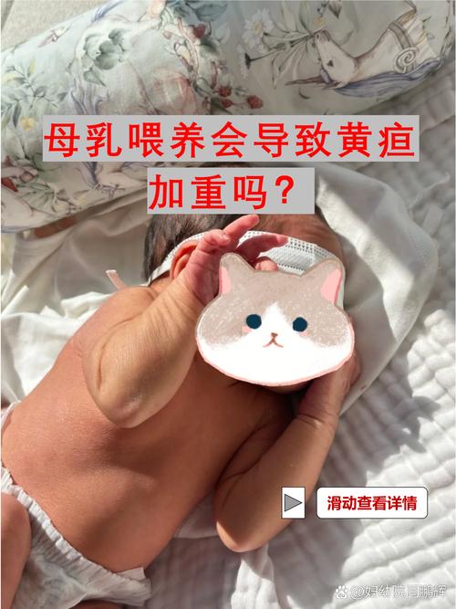 新生儿黄疸期间喝母乳会加重病情吗？需要暂停哺乳吗？-第3张图片-郑州医学网