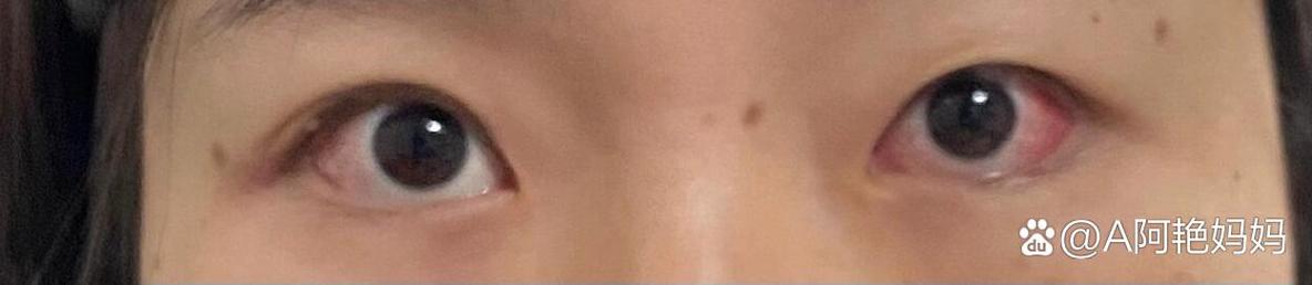 孕期感冒发烧该挂什么科？对胎儿有影响吗？如何安全治疗？-第2张图片-郑州医学网