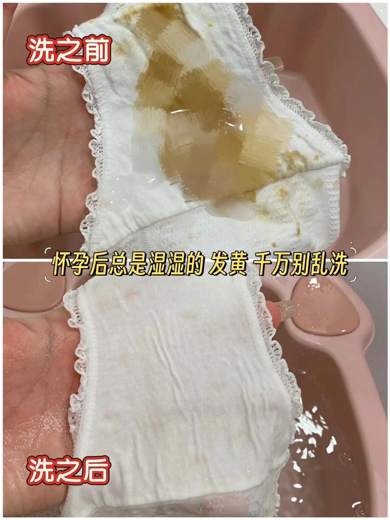 孕期下体有异味但不痒，是正常生理变化还是异常信号？-第3张图片-郑州医学网