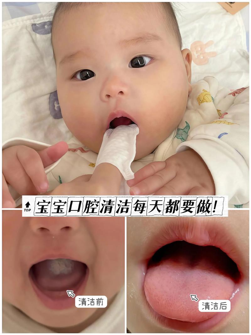新生儿口腔清洁到底该怎么做？棉柔巾、纱布还是专用工具？水温多少才合适？-第1张图片-郑州医学网