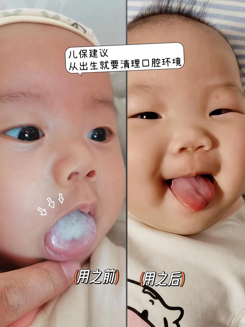 新生儿口腔清洁到底该怎么做？棉柔巾、纱布还是专用工具？水温多少才合适？-第3张图片-郑州医学网