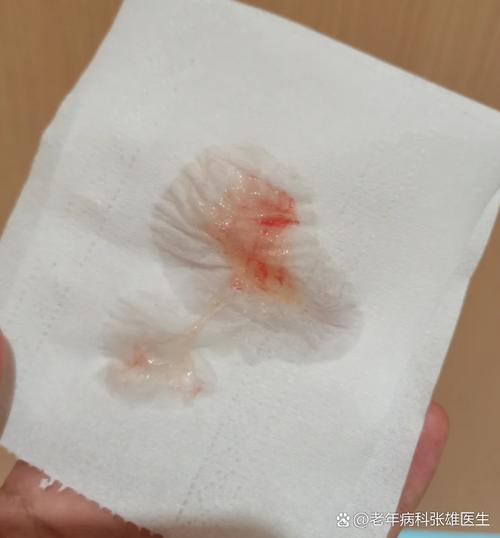 孕期咳嗽会导致出血吗？咳嗽频繁可能引发哪些孕期风险？-第3张图片-郑州医学网