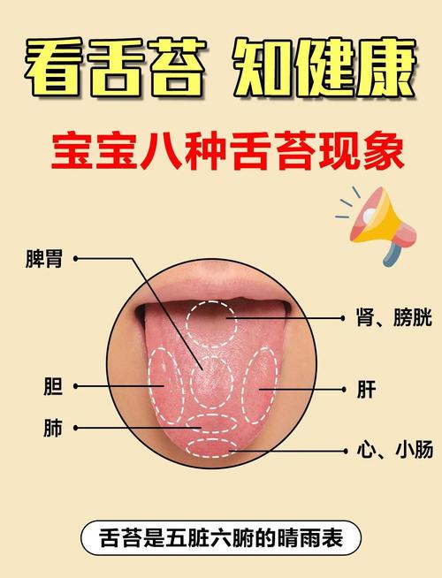新生儿白色舌苔怎么办-第2张图片-郑州医学网