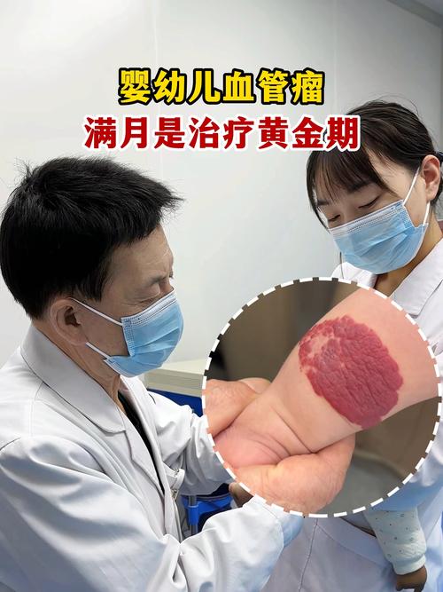 新生儿血管瘤治疗时间越早越好吗？最佳干预时机是什么时候？-第3张图片-郑州医学网