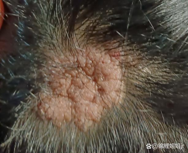 新生儿头皮出现无发区域是何原因？是否需要担心或就医干预？-第1张图片-郑州医学网