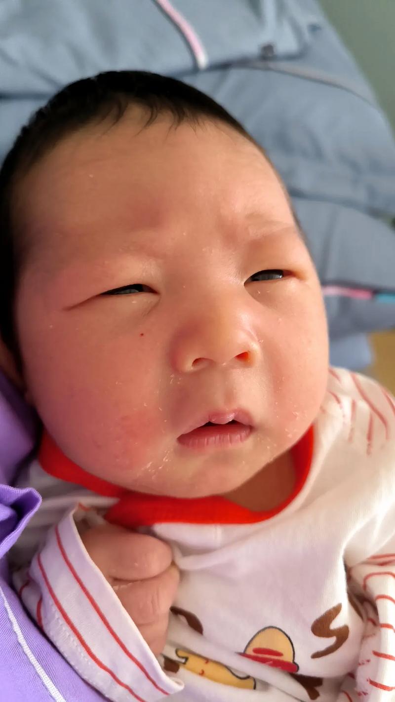 新生儿甲减症状有哪些？早期识别关键指标与异常表现有哪些？-第1张图片-郑州医学网