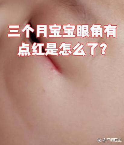 儿童眼睛周围出现红血点，是过敏还是疾病信号？需警惕哪些潜在风险？-第3张图片-郑州医学网