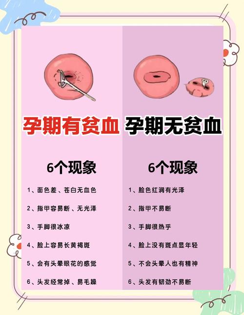 孕期贫血真的能判断胎儿性别吗？科学依据在哪里？-第1张图片-郑州医学网