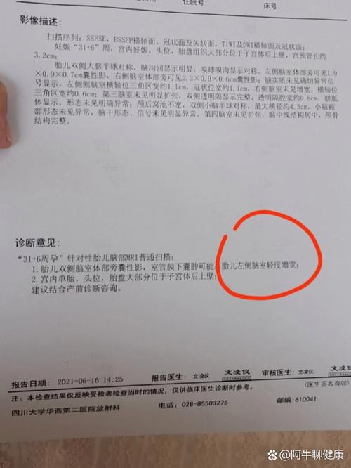 新生儿右侧室管膜囊肿需要治疗吗？会影响发育吗？-第2张图片-郑州医学网
