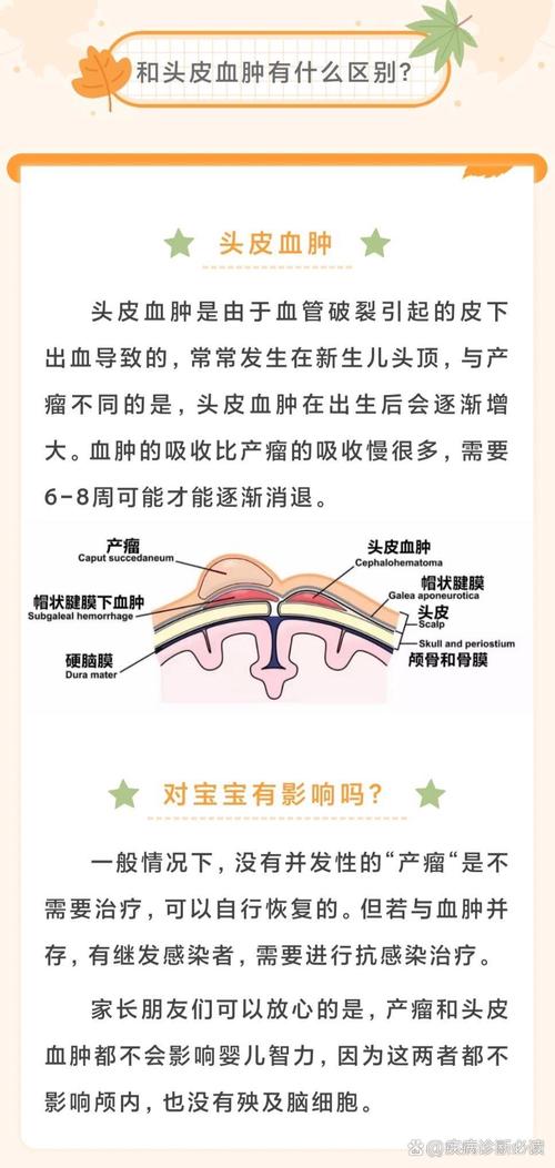 新生儿右侧室管膜囊肿需要治疗吗？会影响发育吗？-第3张图片-郑州医学网