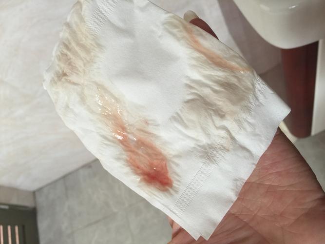 孕期28周白带有血丝是早产征兆吗？需要立即就医检查吗？-第1张图片-郑州医学网