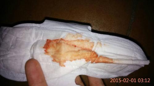 孕期28周白带有血丝是早产征兆吗？需要立即就医检查吗？-第2张图片-郑州医学网