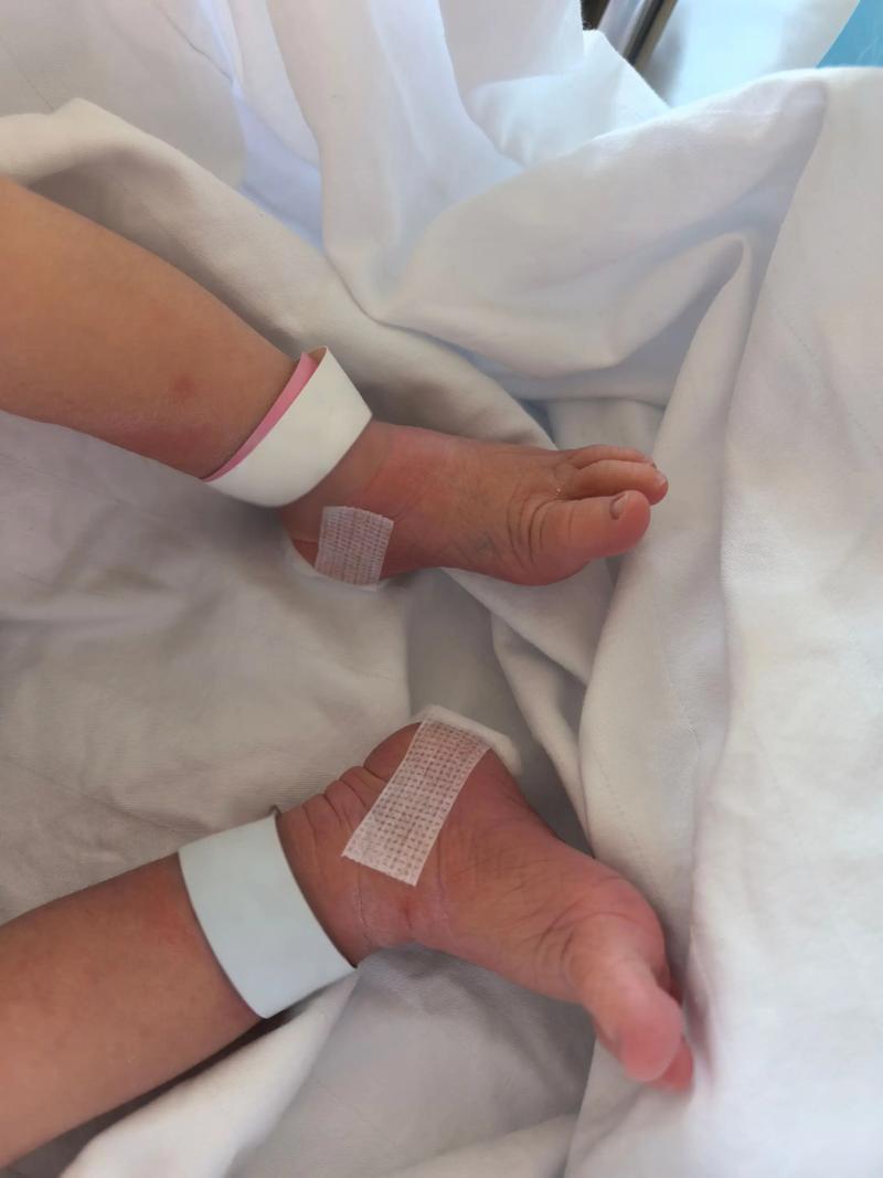 新生儿采足底血到底在出生后第几天最合适?采血时间会不会影响检测结果准确性?-第1张图片-郑州医学网 新生儿采足底血到底在出生后第几天最合适?采血时间会不会影响检测结果准确性?-第1张图片-郑州医学网