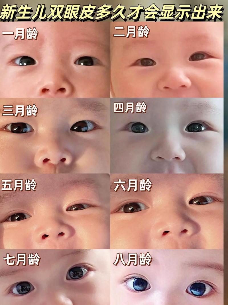 新生儿双眼皮是天生还是后天形成？如何科学判断宝宝双眼皮是否会变化？-第2张图片-郑州医学网