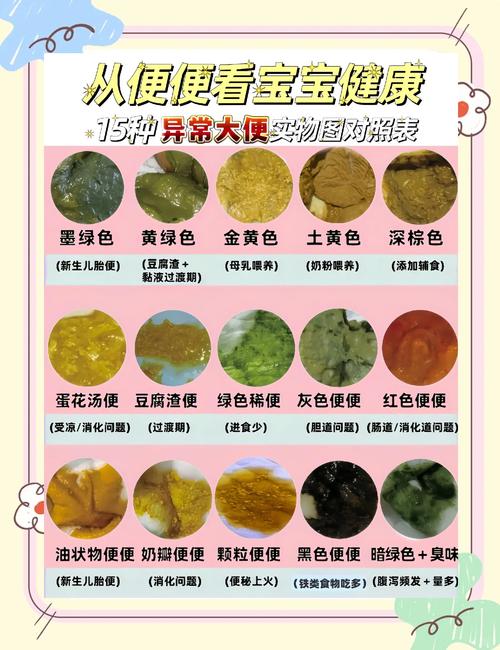 新生儿什么样的大便算正常？颜色、性状、频率有标准吗？-第1张图片-郑州医学网