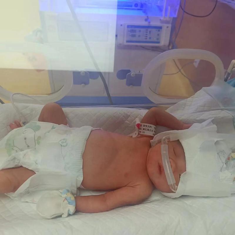 深圳新生儿保温箱费用能报销吗？报销比例和流程是怎样的？-第3张图片-郑州医学网