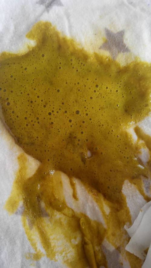 新生儿大便有泡沫是消化不良还是感染？需要就医吗？-第3张图片-郑州医学网