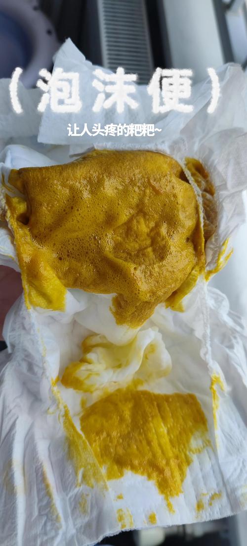 新生儿大便有泡沫是消化不良还是感染？需要就医吗？-第1张图片-郑州医学网