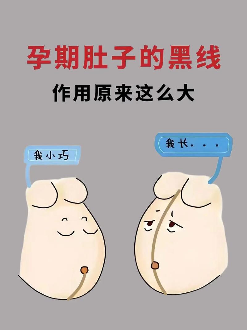 孕期没有妊娠线是体质特殊还是激素水平异常？-第2张图片-郑州医学网