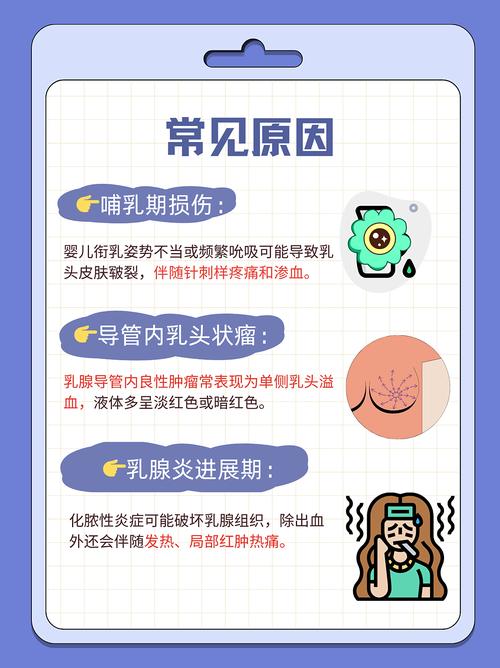 孕期乳头出血是何原因导致的?需要警惕哪些疾病风险?-第2张图片-郑州医学网 孕期乳头出血是何原因导致的?需要警惕哪些疾病风险?-第2张图片-郑州医学网