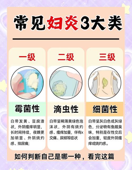 孕期白带突然减少，是身体正常变化还是健康预警信号？-第3张图片-郑州医学网