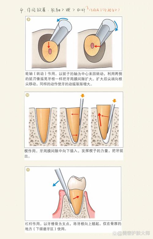 儿童自己在家拔牙如何才能做到真正不痛且安全？-第3张图片-郑州医学网