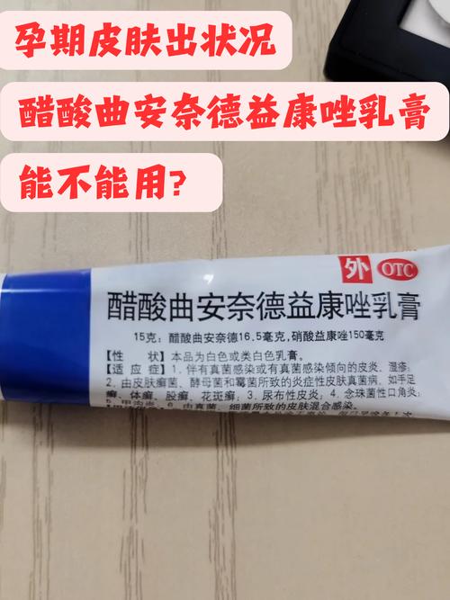 孕期霉菌感染用药安全吗？哪些药物对胎儿影响小？-第1张图片-郑州医学网