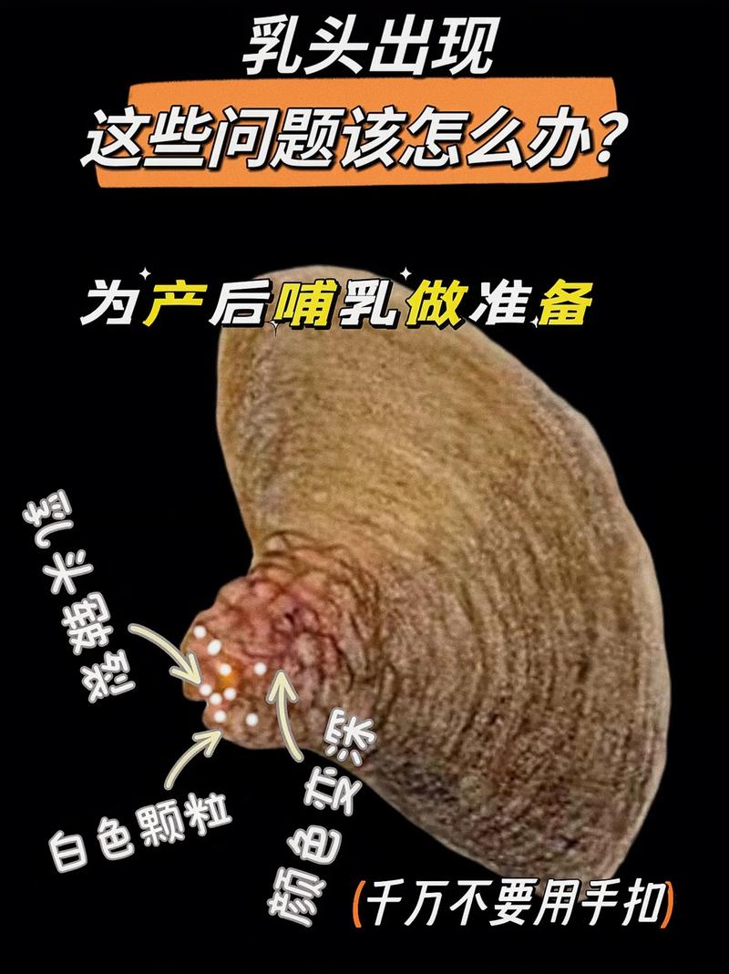 早孕期乳房胀痛、乳晕变黑是正常现象吗？还有哪些症状需要警惕？-第1张图片-郑州医学网
