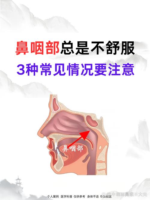 孕期鼻炎咽炎综合症状为何高发?如何缓解才能不影响胎儿健康?-第3张图片-郑州医学网 孕期鼻炎咽炎综合症状为何高发?如何缓解才能不影响胎儿健康?-第3张图片-郑州医学网