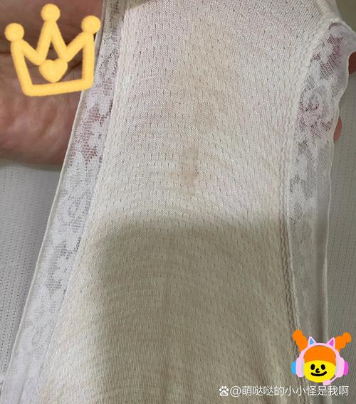 孕期水样白带干后发黄是感染信号吗？需警惕哪些异常情况？-第3张图片-郑州医学网