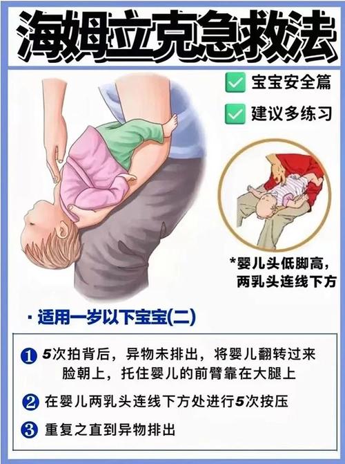 新生儿窒息后护理常规具体包含哪些关键步骤及注意事项？-第3张图片-郑州医学网